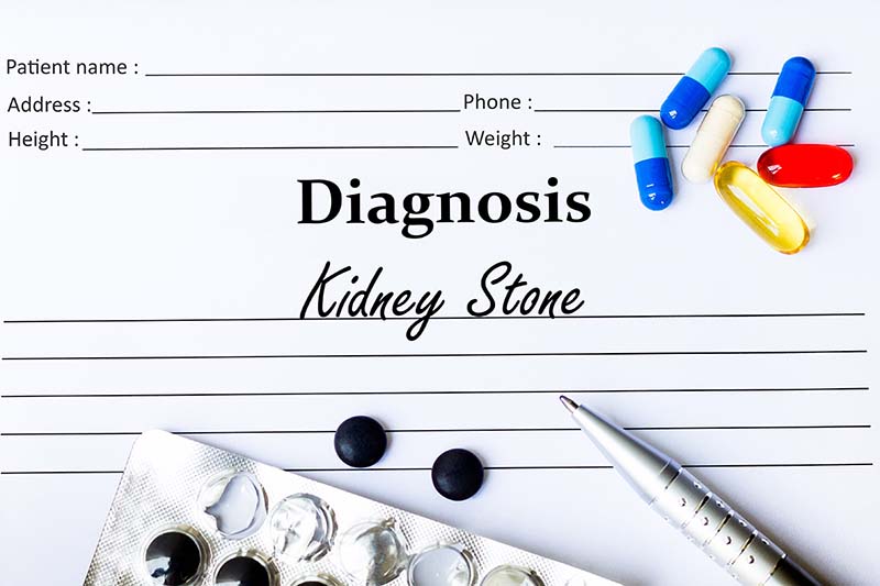 Kidney stone diagnosis written on medical paper.